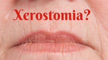 Xerostomia with dry mouth