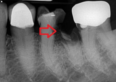 Dental Care for Seniors [Gerodontics]-Complete Guide | Cranford Dental